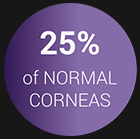 25 percent of Normal Corneas