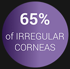 65 Percent of Irregular Corneas